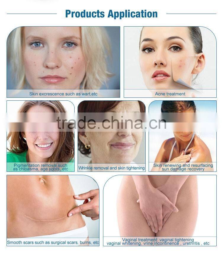 2016 Alibaba express scar repair beauty equipment Fractional CO2 Laser with usa imported laser tube