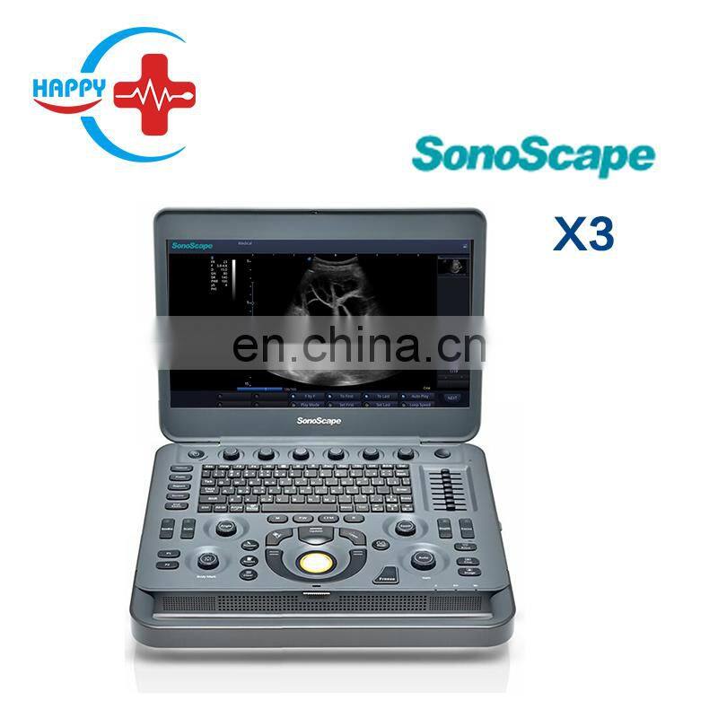 Cheap medical Sonoscape x3 ultrasound machine/Laptop ultrasound scanner/Portable ultrasound probe