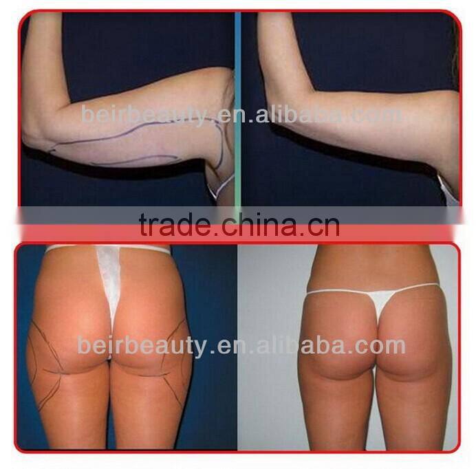 New products looking for distributor! 528 Diodes lipoLaser / Lipo Laser Machine/ Lipo Laser Slimming Machine