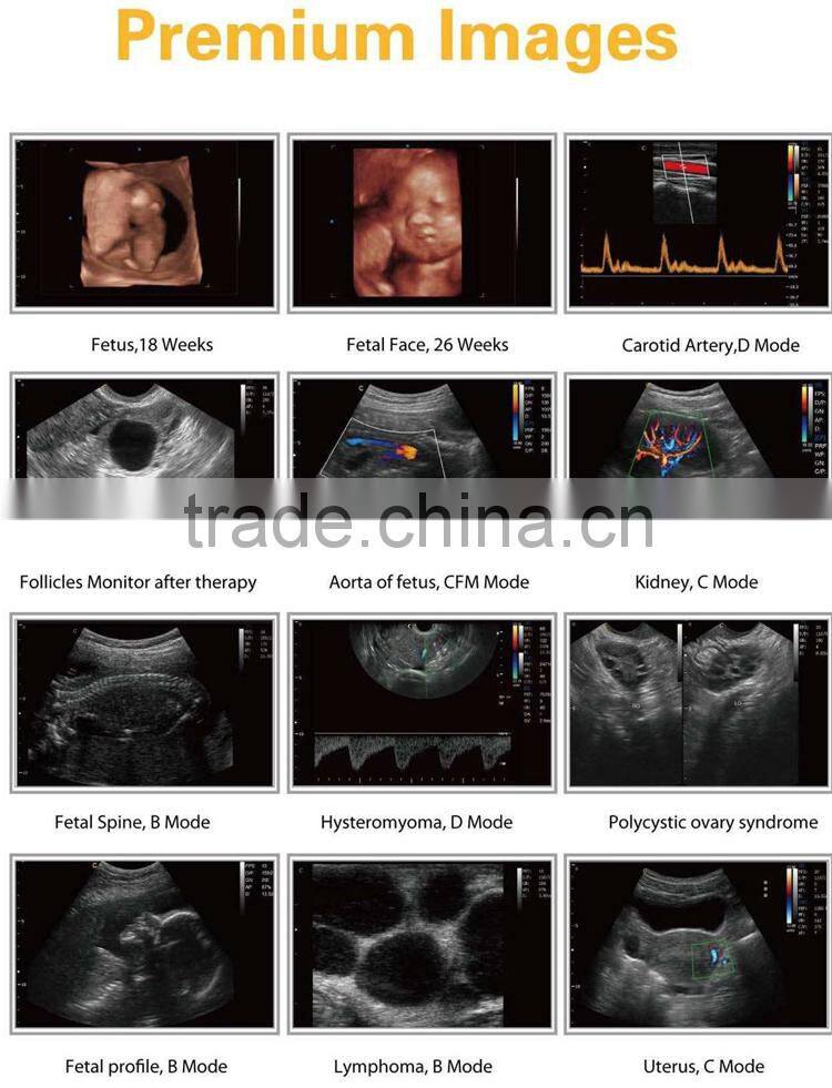 Portable Doppler Ultrasound Machine
