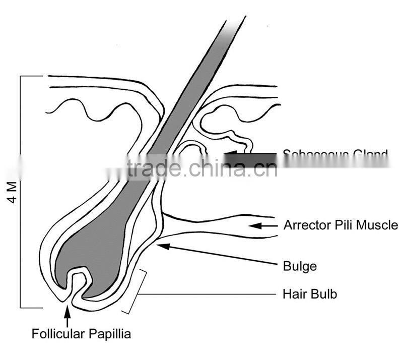Surgical instruments permanent body hair remover laser