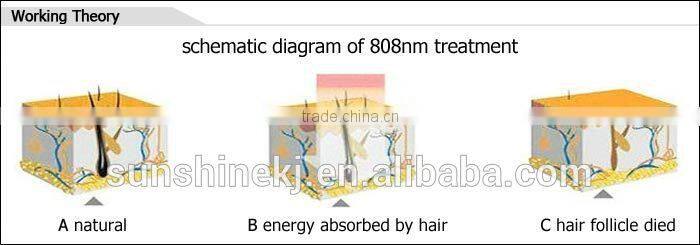 Newest style vertical elight and 808 diode laser hair removal machine (CE)/hair removal and skin rejuvenation machine