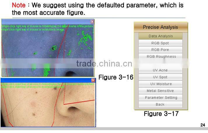 3D facial skin analyzer scanner dialysis machine analyzer machine