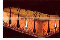 b1 ipl with ipl filters TGA, ISO13485