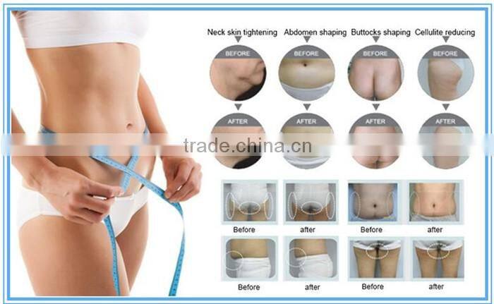 slimming egg ozone sauna spa capsule dydro massage machine spa capsule for sale