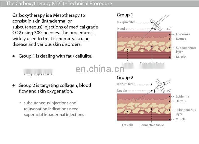 CE approved CDT carboxytherapy beauty machine for C2P injector black eye removal