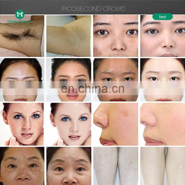 permanent  ipl hair removal device ipl laser hair removal machine ice ipl lamp handset shr hr epilator handle 2022