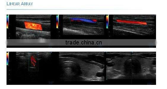 Abdominal/ Vascular/OB/GYN/4D Ultrasound iSpark 480 with CE Approved