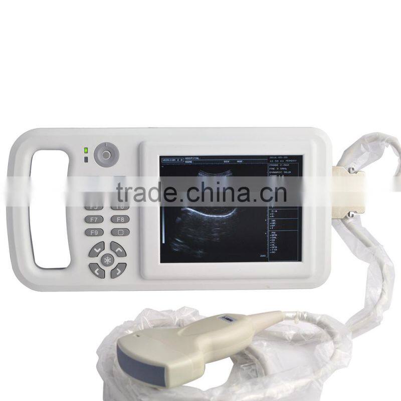 Compact Handheld Ultrasoud Scanner RUS-8000A 3.5MHz convex array probe Made-in-China