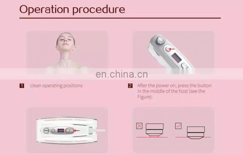 mini Hifu Hello Skin pink portable Neck Wrinkles Removal Home Use beauty machine