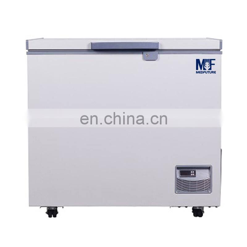 MedFuture mini cool refrigerator 100l laboratory refrigerator freezer horizontal cooler
