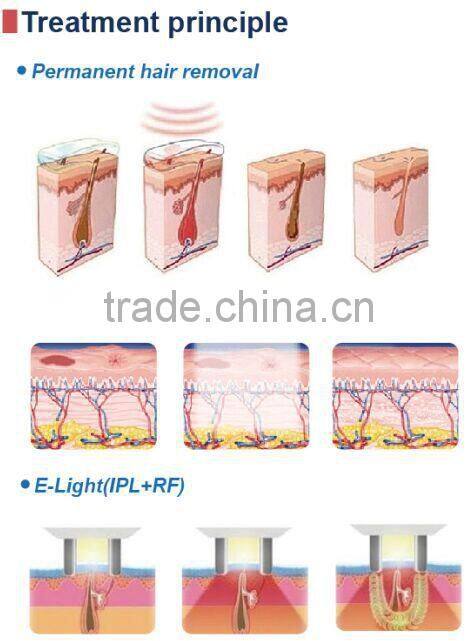 Most effective hair removal &skin rejuvenation machine hair depilate