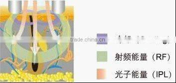 Hot !!! portable hair epilator with CE certificate