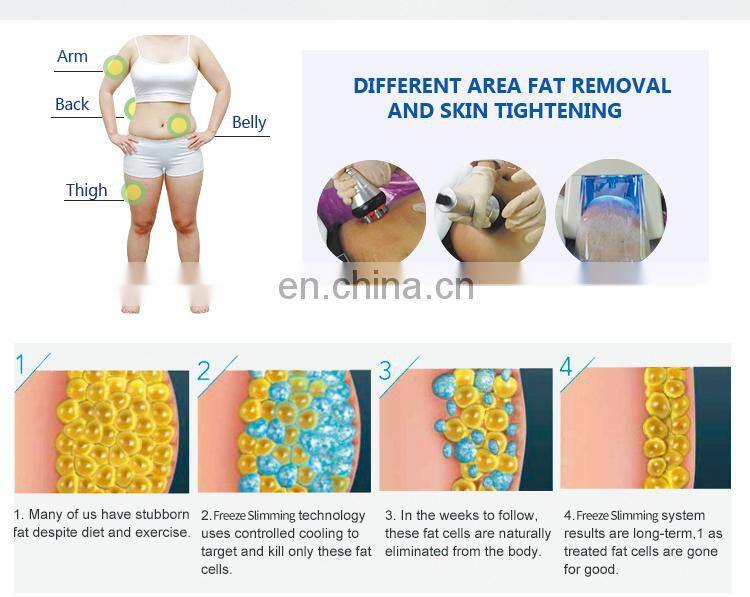 Hot fat removal ! cryo body sculpting machine/fat freeze slimming fat removal