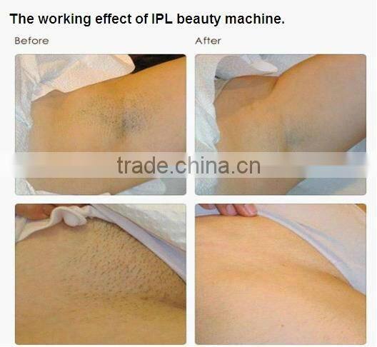 Muti-Function Beauty Equipment IPL SHR Laser