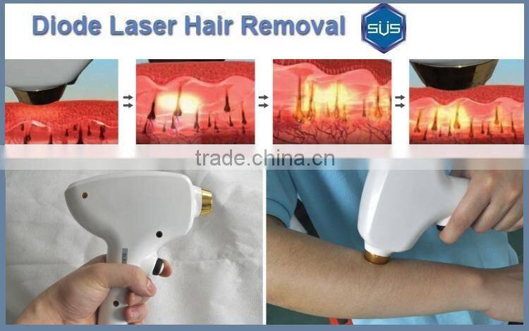 2016 Hot Selling Products vertical 808nm for permanent hair depilation