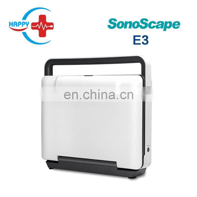 Hot Sale Sonoscape E3 Portable 15 Inch LCD Laptop Ultrasound Device Color Doppler Ultrasound Machine