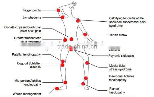 SW9 shockwave therapy pneumatic balistic pain treatment
