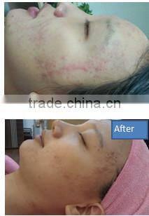 2014 Professional Oxygen Beauty System Oxy 95% Oxygen Water Oxygen Machine