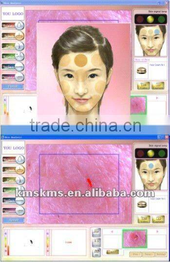 Intelligent Skin Diagnosis protable Skin Analyzer