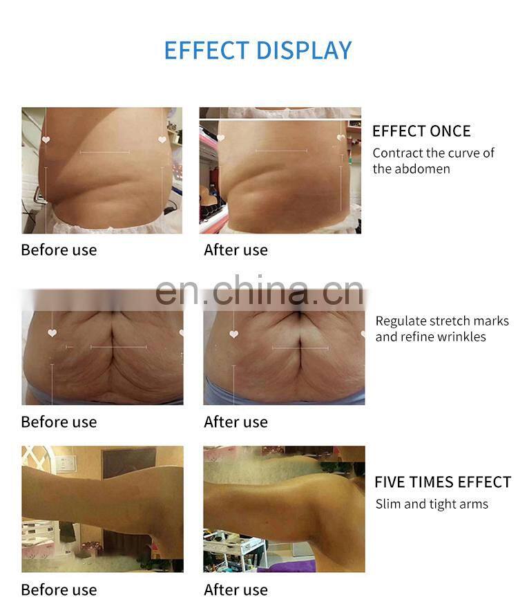 3 IN 1 Body Shaping Machine Microwave+Microcurrent+Vacuum Negative Pressure Weight Loss Device Body Physiotherapy Massage