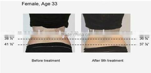 Alibaba China Suppier rf face lift machine photon ultrasonic device cavitation rf machine,New face NV-i3