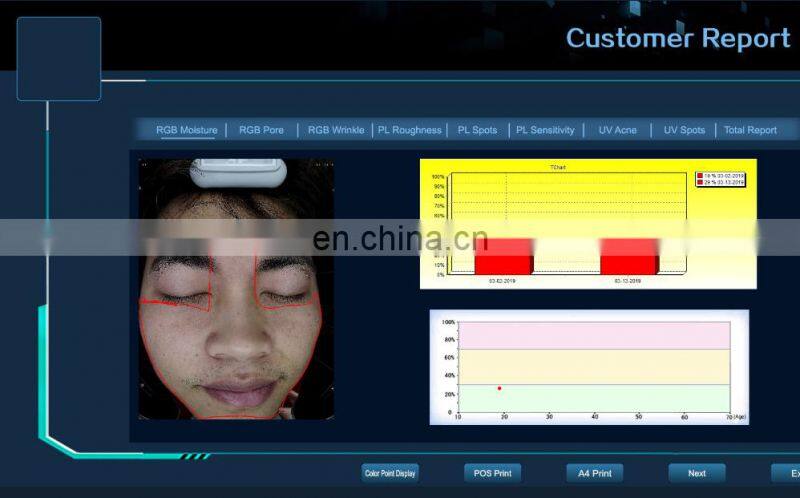 Sales 2022 Hot seal magic mirror facial UV Mositure tester Grease Wrinkle skin analyzer