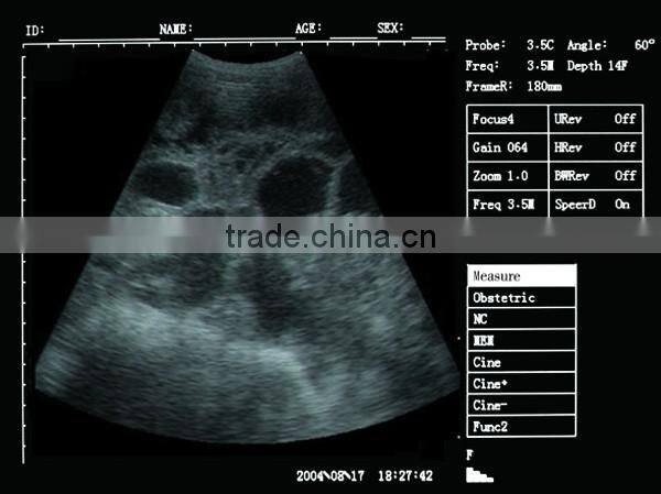 Sonostar good quality handheld portable vet ultrasound scanner pig veterinary ultrasound V6