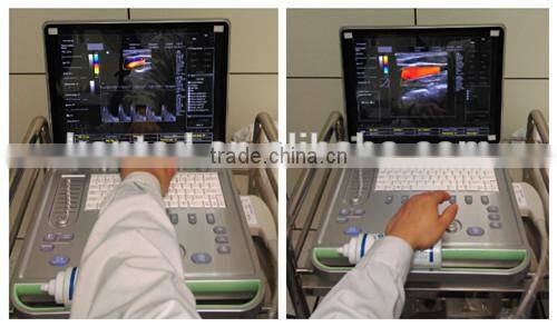 C7 KONTED 3D Portable Color Doppler Ultrasound Machine
