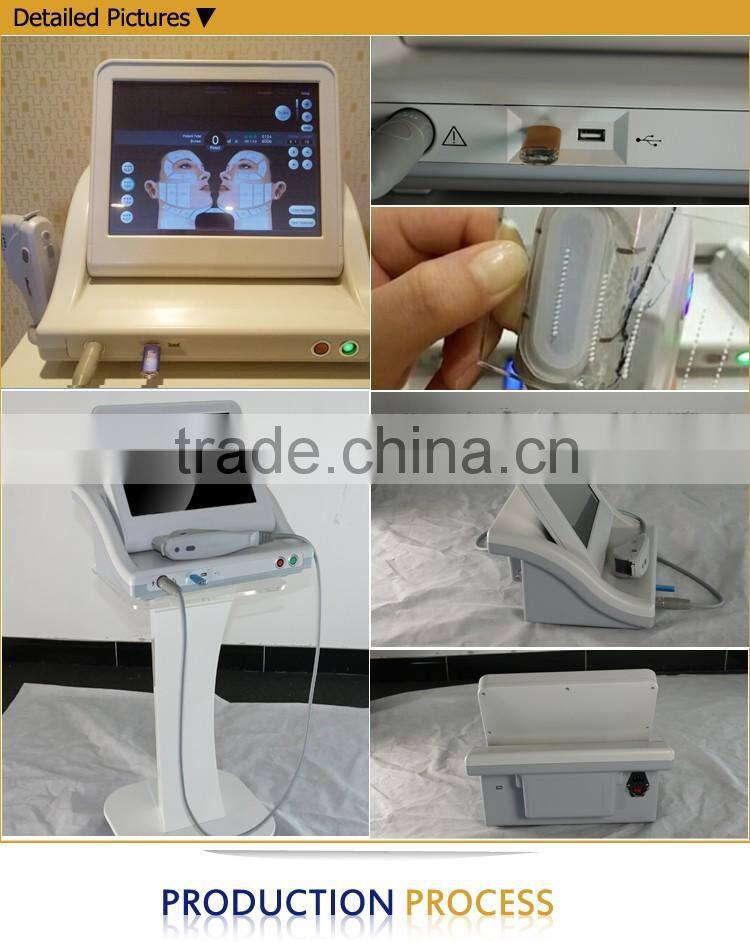 2016 ultrasonic smas system hifu body body and face treatment