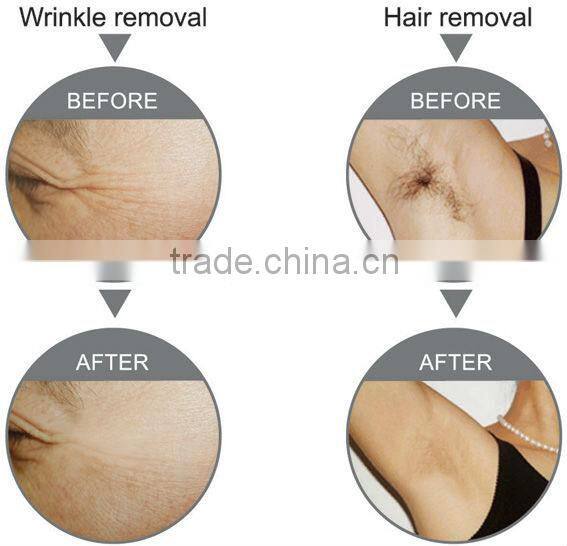 High performance chinese Multifunctional beauty machine