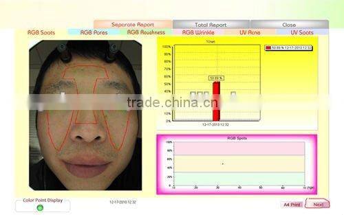WT-01-S Portable Magic Mirror skin diagnosis system