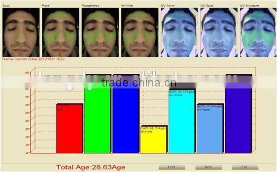 Facial skin moisture oil analyser/Skin Moisture Tester