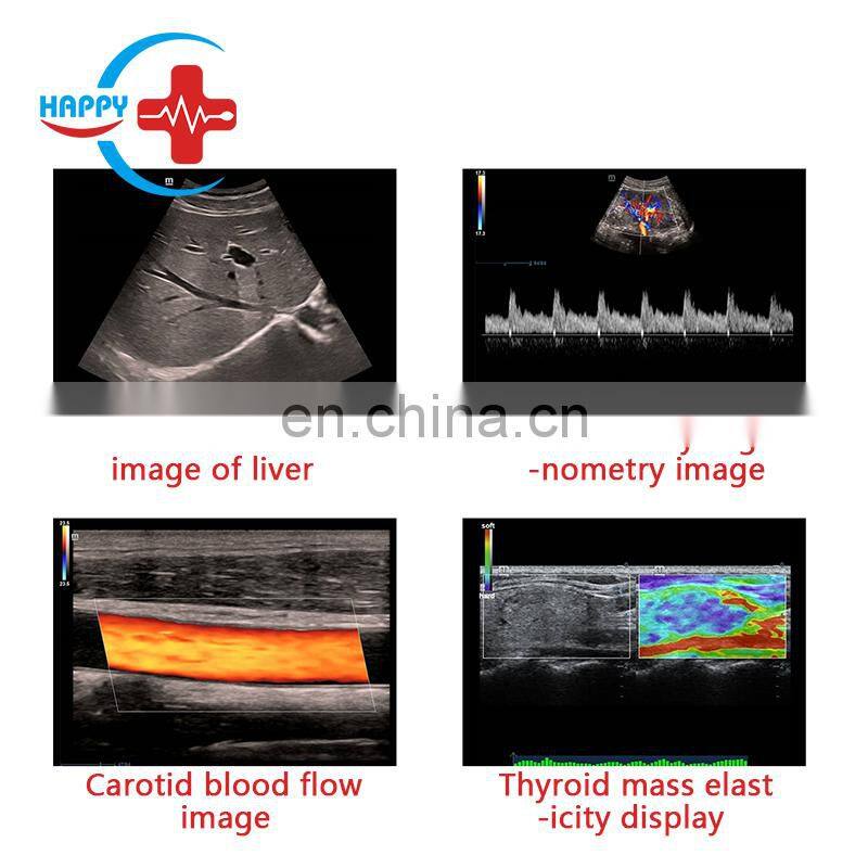 Best-selling Trolley Mindray dc-40 color doppler ultrasound machine portable Mindray ultrasound device