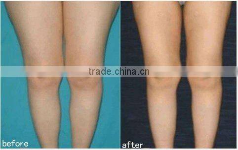 New beauty machine bipolar RF/slimming/ Ultrasonic liposuction/ Bio facial machine