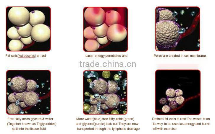 stationary lipolaser 528 Diode Fat Removal Cryo Lipolaser Beauty Machine