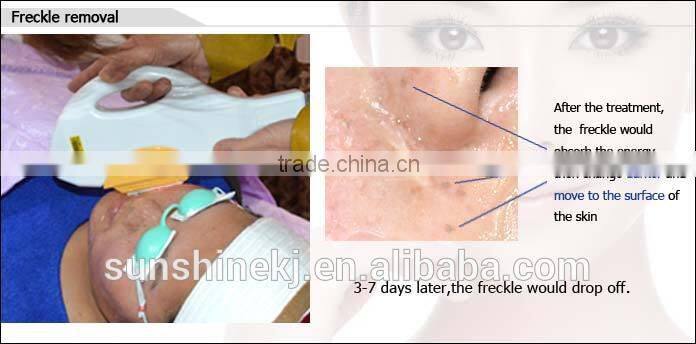 2015 New vertical diode laser 808nm software