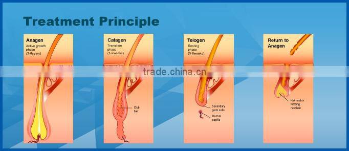 professional manufacuturer elight ipl rf