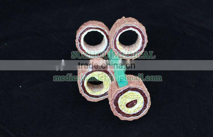 4 piece artery model