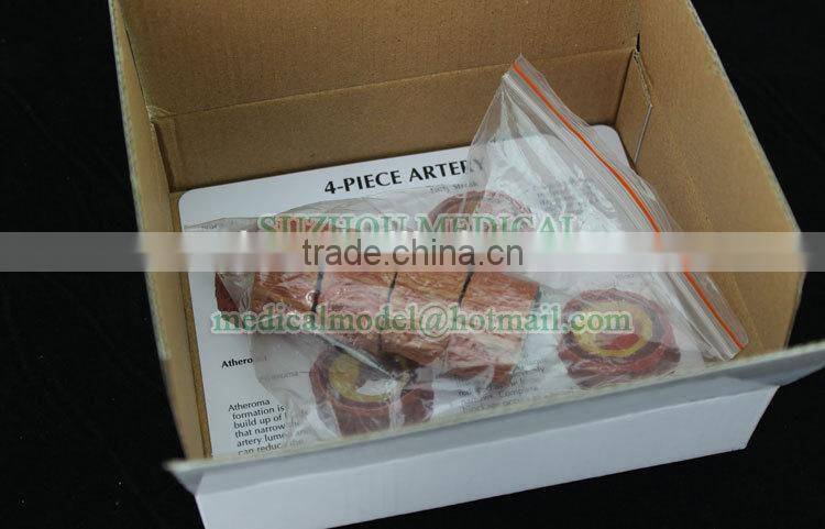 4 piece artery model