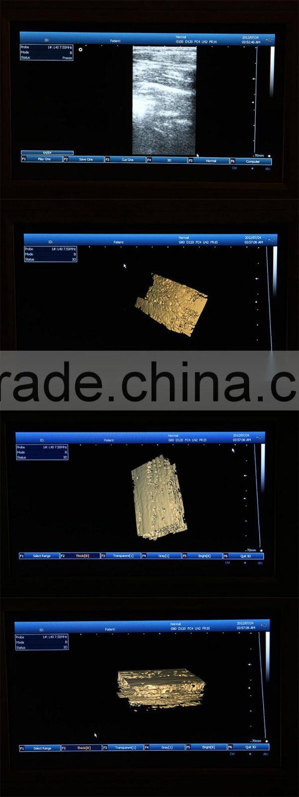 Good Image Portable/Notebook/Laptop RUS-9000E2 ultrasound Scanner/machine with convex probe, linear, vaginal, rectal transducer