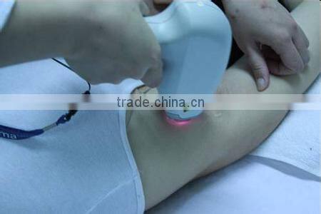 Newly designed high power 808nm diode laser hair remove machine with CE certification