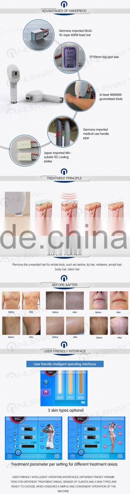 high poewer Painless 808nm diode laser hair removal machine