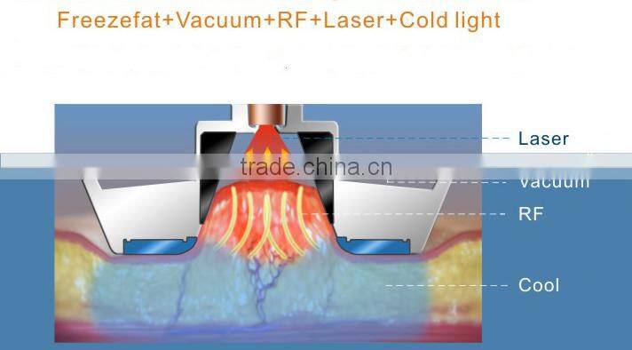 Multipolar RF Vacuum machine for salon use