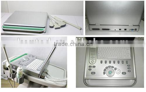 New design artery doppler equipment made in China