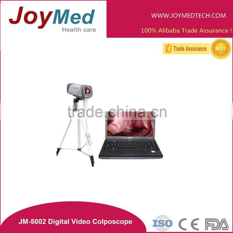 Digital Video Colposcope, Laptop Video Colposcope, Gynecology Video Colposcope