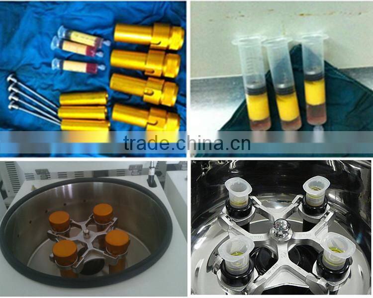 advance sealed caps syinges fat and blood plasma extract centrifuge TD4-MR