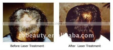 Mini Vibra Laser Hair Growth Comb with CE&Rosh