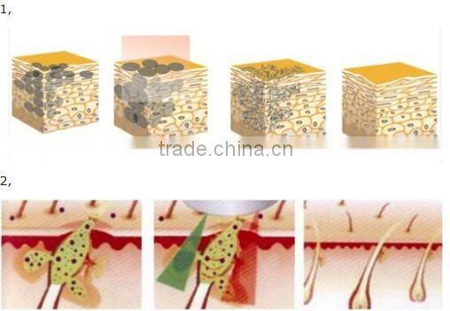 spa use portable ipl skin rejuvenation mini home hair removal ipl 2014