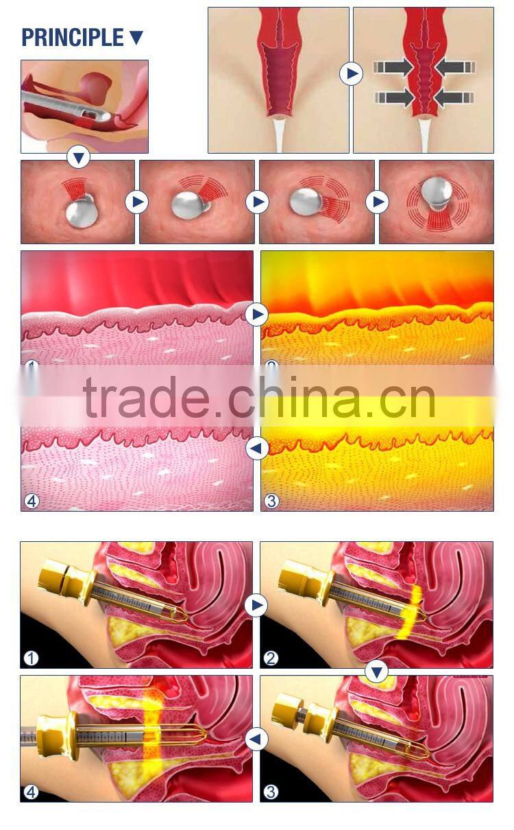 2016 co2 mini laser engraver for beautiful use